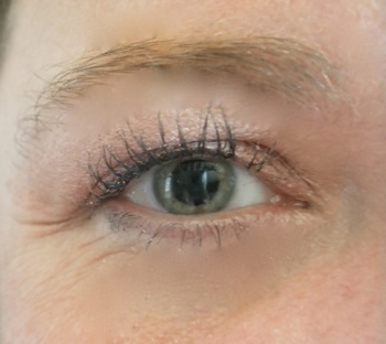 Blurry Vision - Carla Anne Coroy - Carla Anne's dilated eye